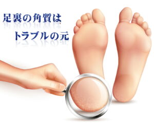 瀬戸市のリラクゼーションルーム シエスタ、足裏角質ケア紹介記事のイラスト画像。かかとを虫眼鏡で拡大し「足裏の角質はトラブルの元」と記載されたデザイン。